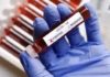 With 3,604 new cases, India's Covid tally surges past 70K: The COVID-19 tally in India surged past 70 thousand cases, with 3,604 new cases reported in the last 24 hours, the Union Health Ministry said on Monday.