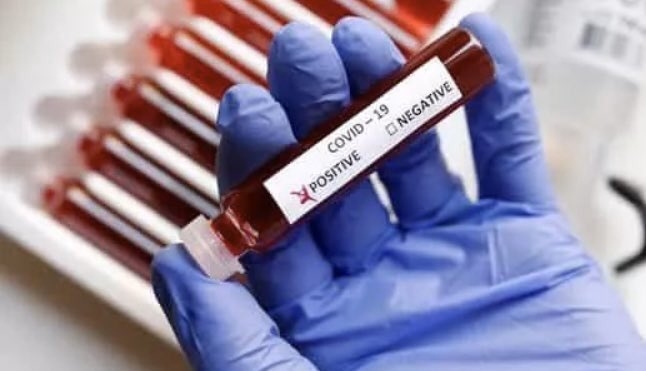 With 3,604 new cases, India's Covid tally surges past 70K: The COVID-19 tally in India surged past 70 thousand cases, with 3,604 new cases reported in the last 24 hours, the Union Health Ministry said on Monday.