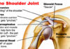 Two Stage Procedure treats complicated Arthritic Shoulder: Mohali, September 18, 2020