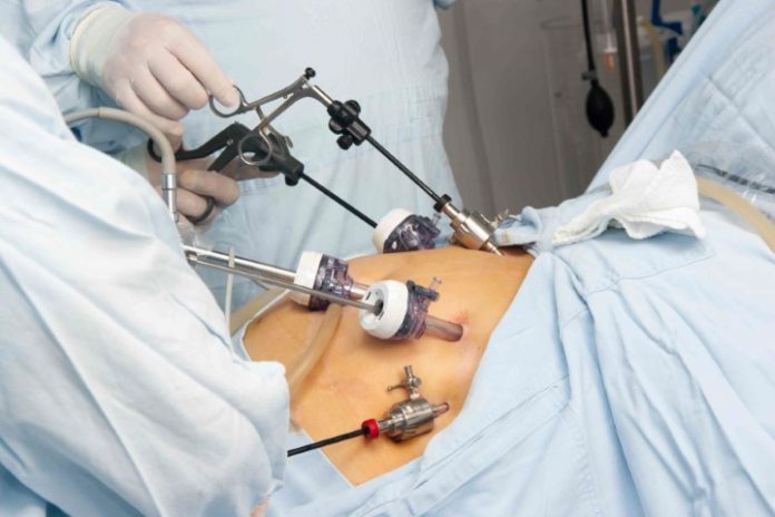 Bariatric Surgery: Ray of hope for obese & diabetic patients