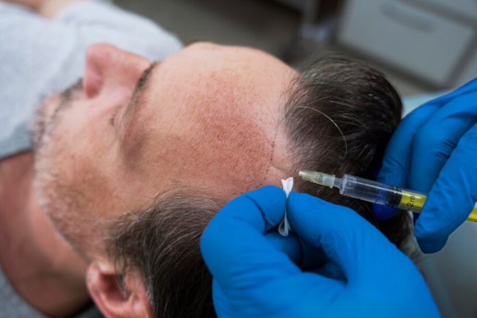 21st century’s Hair Transplantation – Dr. Manas Jain
