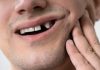 With dental implants