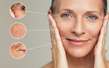 What Causes Your Skin to Age Prematurely