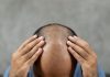 Dr. Harikiran Chekuri Talks About Male Pattern Baldness and How to Treat It