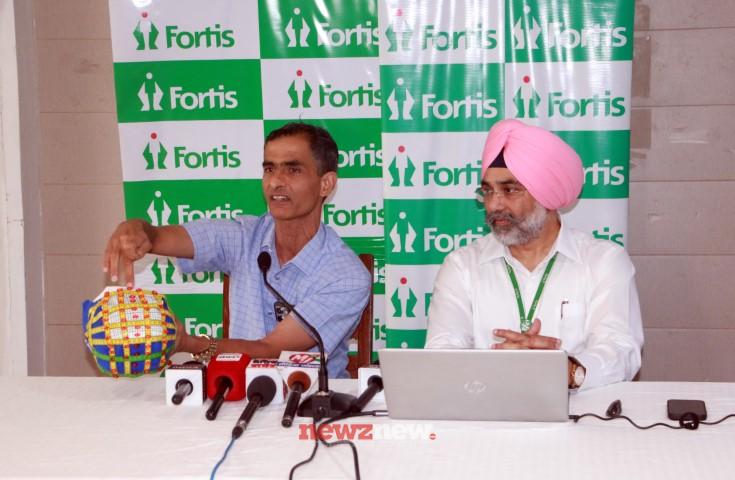 Fortis Hospital Mohali Introduces ‘dTMS’